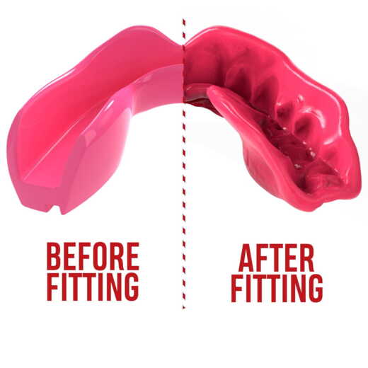 SafeJawz single mouthguard - pink